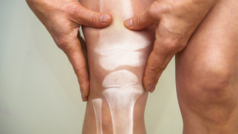 Hands massaging knee with bones shown in X-ray