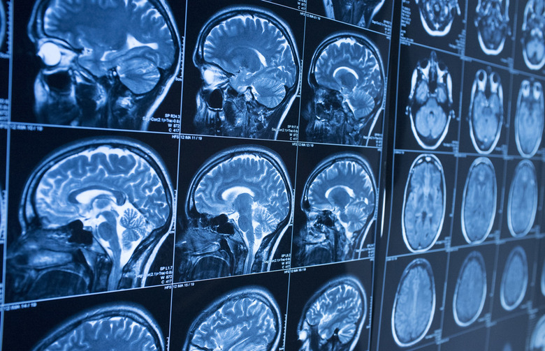 Healthy Brain