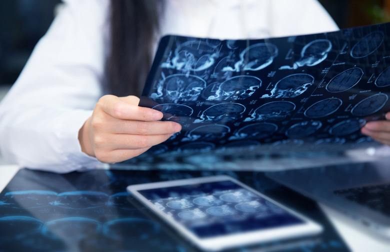 Lowers Risk of Stroke