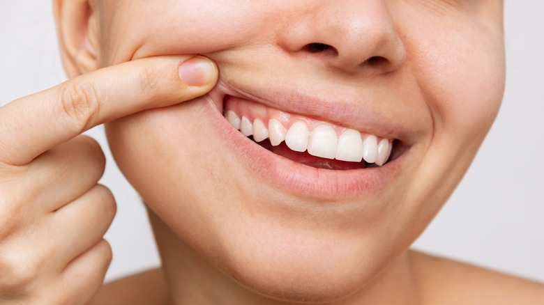 close up of woman's gums and teeth