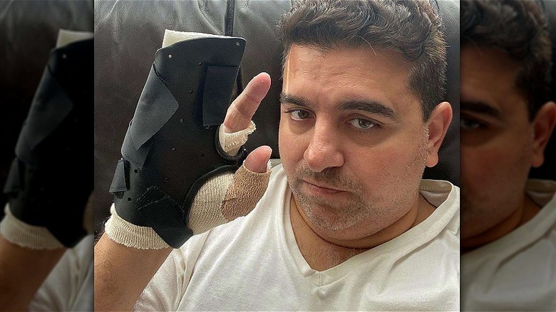 Buddy Holding up Hand Cast